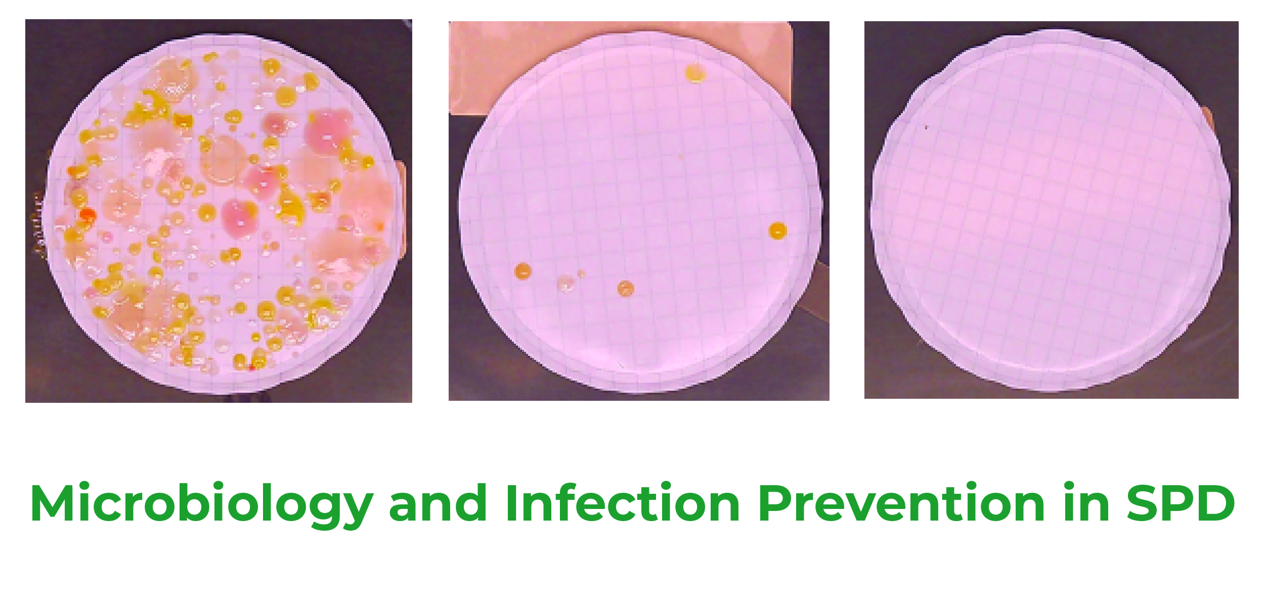 Microbiology and Infection Prevention in SPD