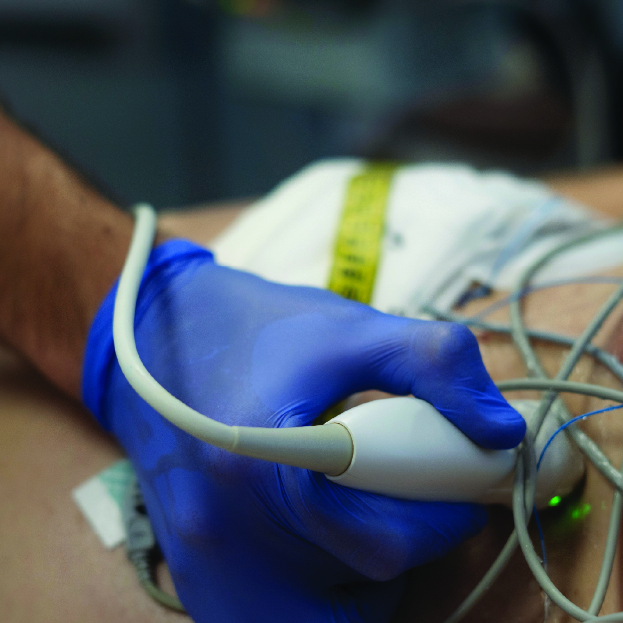 Ultrasound in the Emergency Department