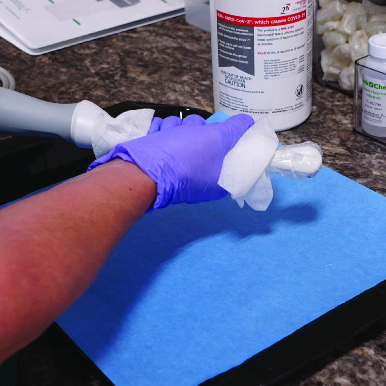 Ultrasound Probe Reprocessing Starts at Point of Use